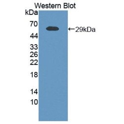 Nicotinamide Phosphoribosyltransferase / Visfatin (NAMPT) Antibody