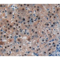 Nicotinamide Phosphoribosyltransferase / Visfatin (NAMPT) Antibody