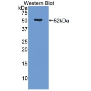 Western blot analysis of the recombinant protein.