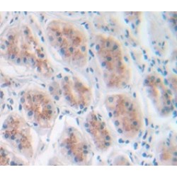 Macrophage Inflammatory Protein 1 Beta (MIP1b) Antibody