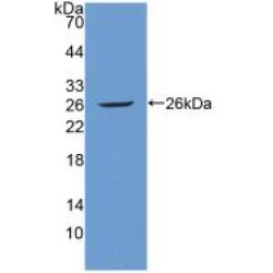 Tyrosine-Protein Kinase Receptor Tie-1 (TIE1) Antibody