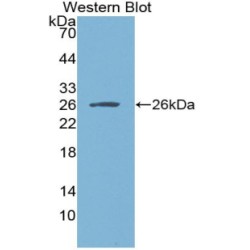Metalloproteinase Inhibitor 3 (TIMP3) Antibody