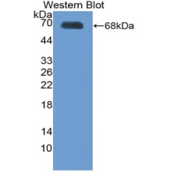 Thrombopoietin (THPO) Antibody