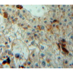 Thrombopoietin (THPO) Antibody