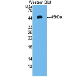 Vascular Endothelial Growth Factor C (VEGFC) Antibody