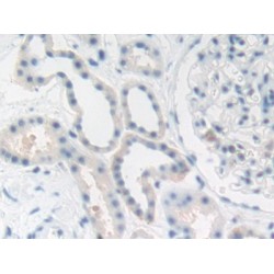 Carcinoembryonic Antigen-Related Cell Adhesion Molecule 5 (CEACAM5) Antibody