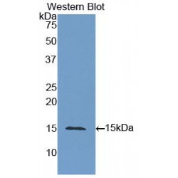 Carcinoembryonic Antigen-Related Cell Adhesion Molecule 5 (CEACAM5) Antibody