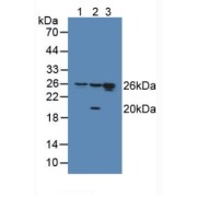 Western blot analysis of (1) Human HeLa cells, (2) Human HepG2 Cells and (3) Human Jurkat Cells.