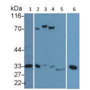 WB analysis of various lysates: Human liver (1), Jurkat cell (2), HeLa cell (3), HepG2 cell (4), Pig liver (5), and Rat cerebrum (6) using CASP3 antibody (0.5 µg/ml) and HRP-conjugated Goat Anti-Rabbit antibody (<a href="https://www.abbexa.com/index.php?route=product/search&amp;search=abx400043" target="_blank">abx400043</a>, 0.2 µg/ml).