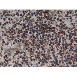 Corticotropin Releasing Hormone (CRH) Antibody