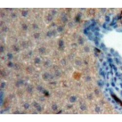 Corticotropin Releasing Hormone (CRH) Antibody