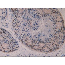 Polyunsaturated Fatty Acid 5-Lipoxygenase (ALOX5) Antibody