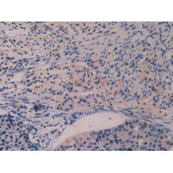 Polyunsaturated Fatty Acid 5-Lipoxygenase (ALOX5) Antibody