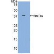 Western blot analysis of recombinant Human MBL.