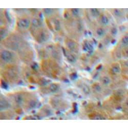 Mannose Binding Lectin (MBL) Antibody