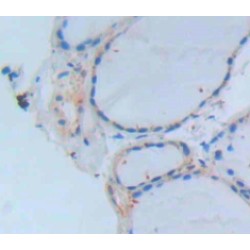 Amylase Alpha 1, Salivary (AMY1) Antibody