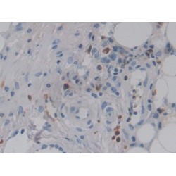 Colony Stimulating Factor 2 Receptor Alpha (CSF2Ra) Antibody