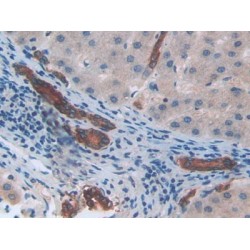 C-X-C Motif Chemokine 2 (CXCL2) Antibody