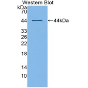 Western blot analysis of the recombinant protein.