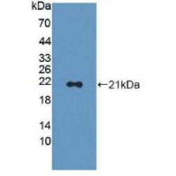Adenylyl Cyclase Associated Protein 2 (CAP2) Antibody