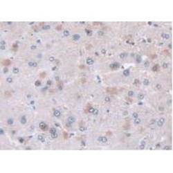 Adenylyl Cyclase Associated Protein 2 (CAP2) Antibody