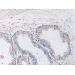 Adenylyl Cyclase Associated Protein 2 (CAP2) Antibody