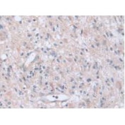 Adenylyl Cyclase Associated Protein 2 (CAP2) Antibody