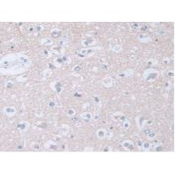 Adenylyl Cyclase Associated Protein 2 (CAP2) Antibody