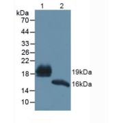 Western blot analysis of (1) Human Urine and (2) Mouse Pancreas Tissue.