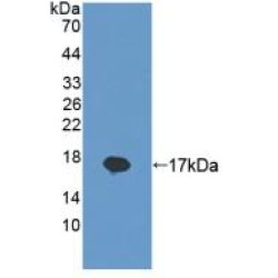 Regenerating Islet Derived Protein 1 Beta (REG1b) Antibody