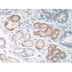 Regenerating Islet Derived Protein 1 Beta (REG1b) Antibody