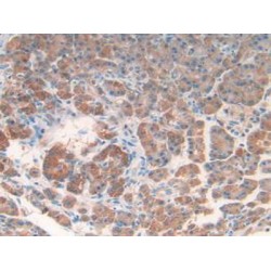 Regenerating Islet Derived Protein 1 Beta (REG1b) Antibody