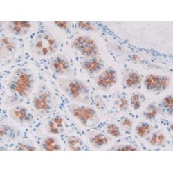 Regenerating Islet Derived Protein 1 Beta (REG1b) Antibody