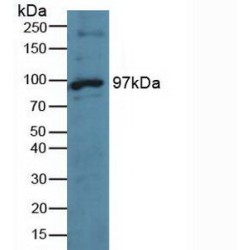 TTK Protein Kinase (TTK) Antibody