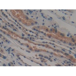 TTK Protein Kinase (TTK) Antibody