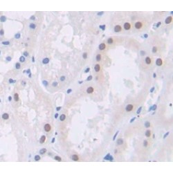 Polybromo 1 (PBRM1) Antibody