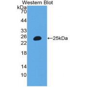 Western blot analysis of the recombinant protein.