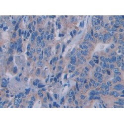 Semaphorin 3A (SEMA3A) Antibody