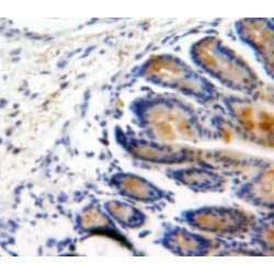 Bone Morphogenetic Protein 2 (BMP2) Antibody