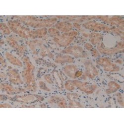 Receptor-type tyrosine-protein kinase FLT3 (FLT3) Antibody