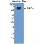 Western blot analysis of the recombinant protein.