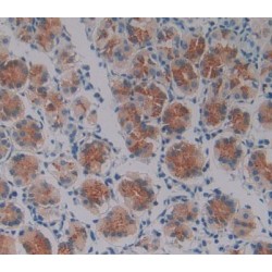 Oncostatin M (OSM) Antibody