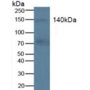 Western blot analysis of Human Blood Cells.