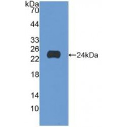 Mast/Stem Cell Growth Factor Receptor Kit (KIT) Antibody