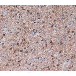 Nischarin (NISCH) Antibody