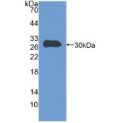 Western blot analysis of recombinant Human TLN.