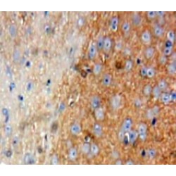 Talin (TLN) Antibody