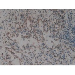 Calnexin (CANX) Antibody