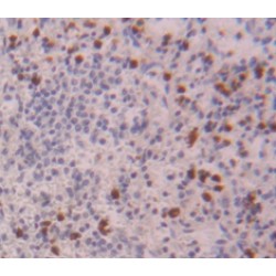 Neutrophil Cytosolic Factor 4 (NCF4) Antibody