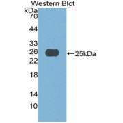 Western blot analysis of recombinant Human ACF.